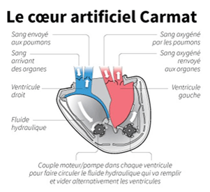 lecoeurartificielcarmat